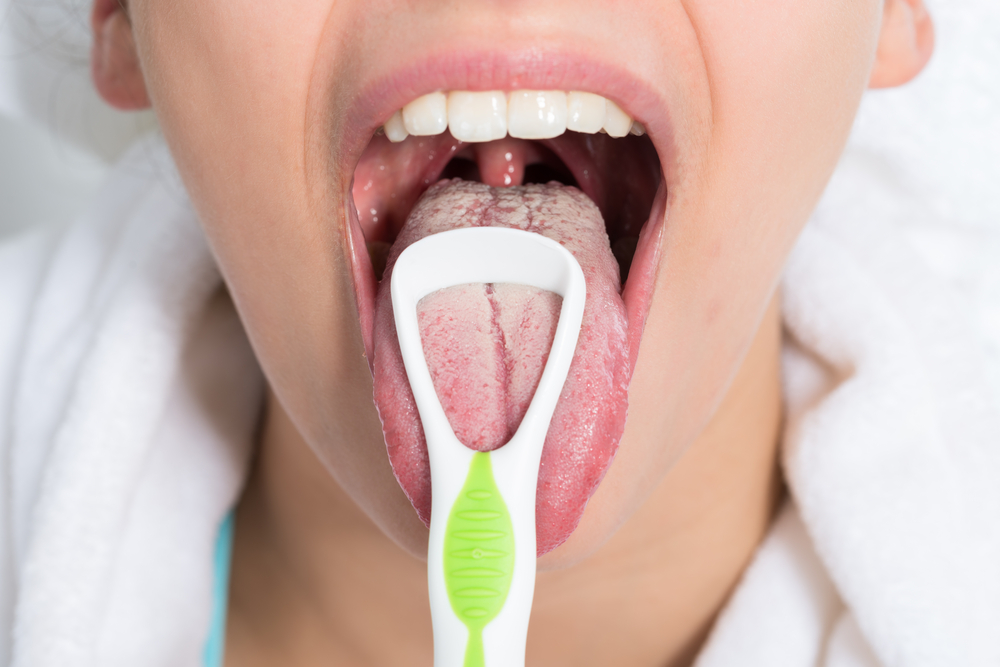 舌磨きをしてもすぐに舌が白くなる…。それは細菌がバイオフィルムという膜に守られているから舌磨きでは取れないのです。